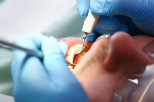 Best Weekend Emergency Dentist in Carnegie, OK