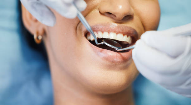 Best Emergency Dental Surgery in Carnegie, OK
