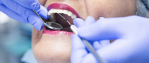Best Emergency Wisdom Teeth Removal in Carnegie, OK